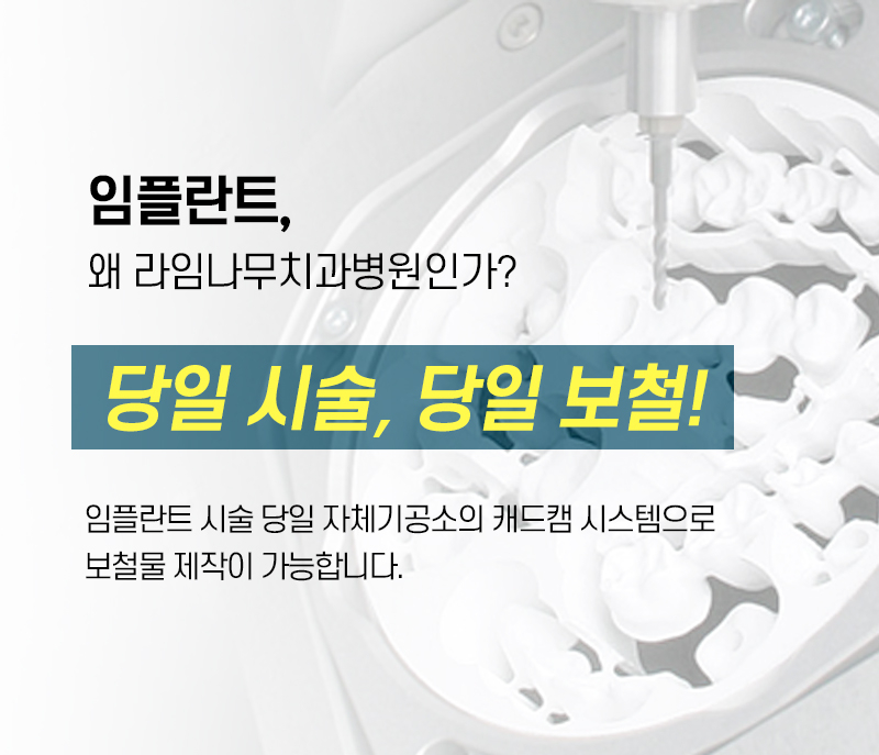 임플란트로 상실한 치아 고민 해결해 보세요 관련 이미지 6