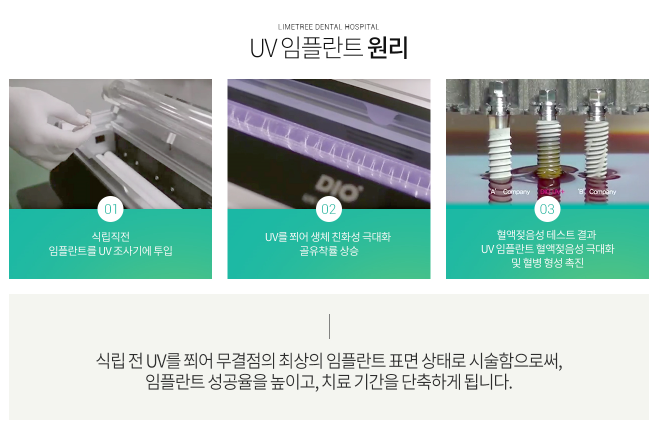 임플란트 기간 얼마나 걸릴까? 임플란트 뼈이식, 임플란트 종류 관련 이미지 8