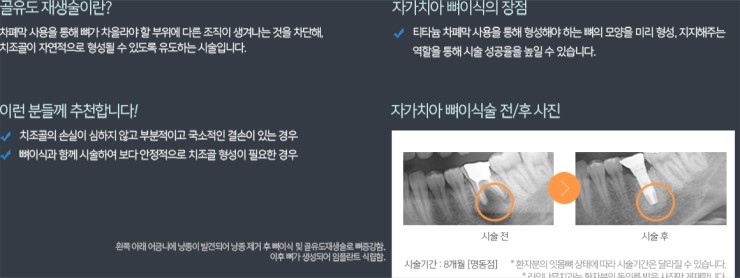 라임나무치과의 임플란트 솔루션을 소개합니다. 관련 이미지 8