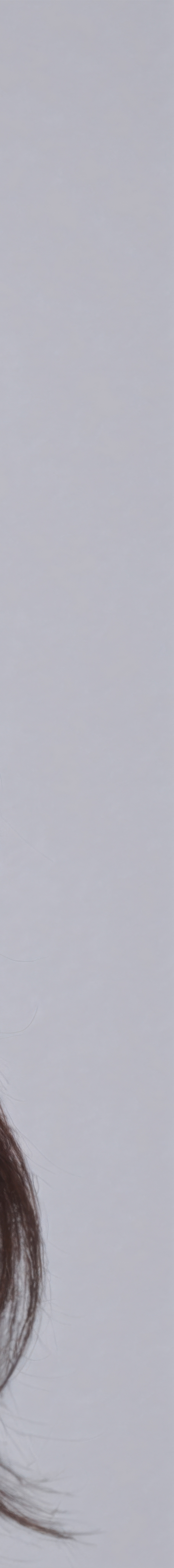 강남역여드름압출 아트레이저로 가능하기에 관련 이미지 31