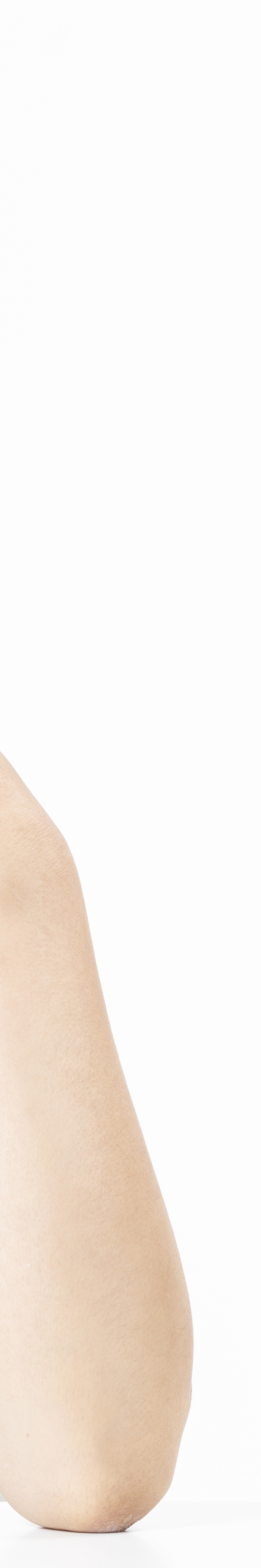 한관종 비립종 차이 어떻게 구분할 수 있을까 관련 이미지 32