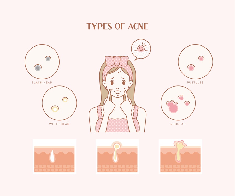 강남피부과 전문의 선택이 중요한 이유 관련 이미지 3