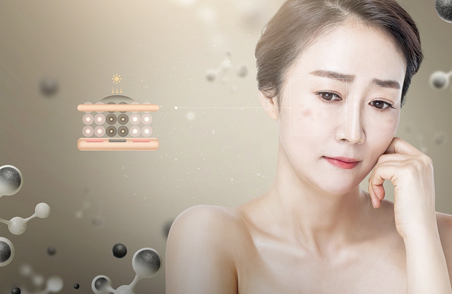 기미 검버섯 제거 피부과 진료를 통해 관련 이미지 6