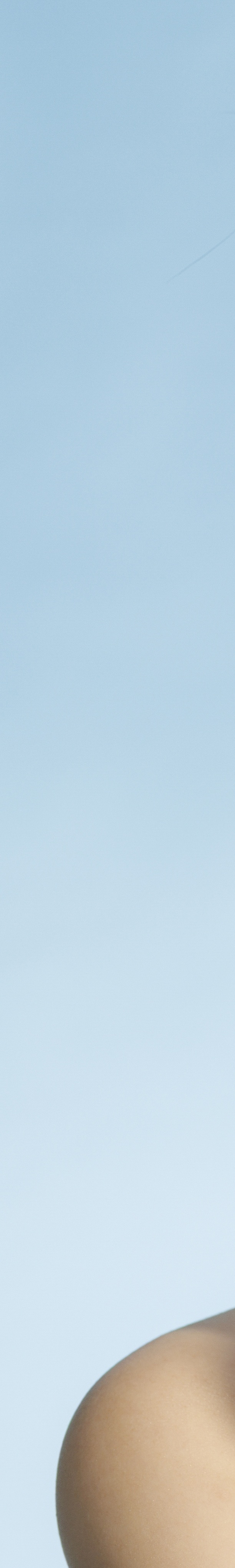 신논현역 써마지 한 번으로 달라진 얼굴 관련 이미지 14