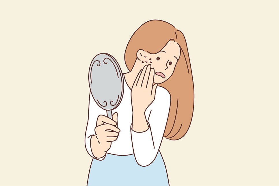 The Care Sequence Differs for Red Marks and Depressed Acne Scars in Bundang image 2