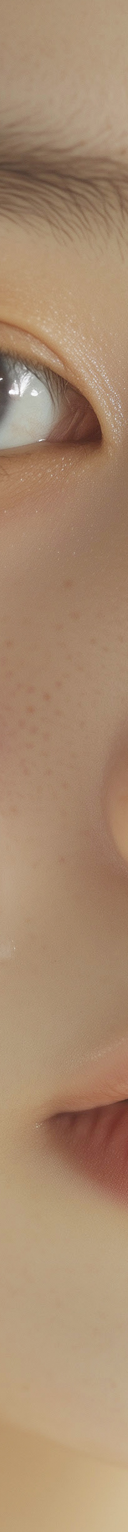 강남역여드름압출 이렇게 진행해야 해요 관련 이미지 28