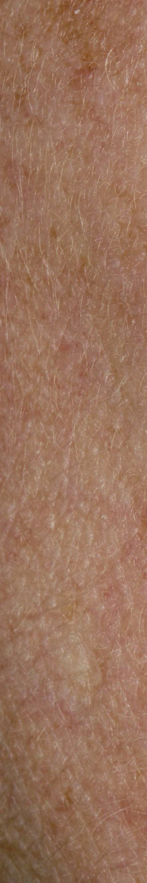 서초안면홍조 어떤 것부터 확인해야 할까 관련 이미지 14