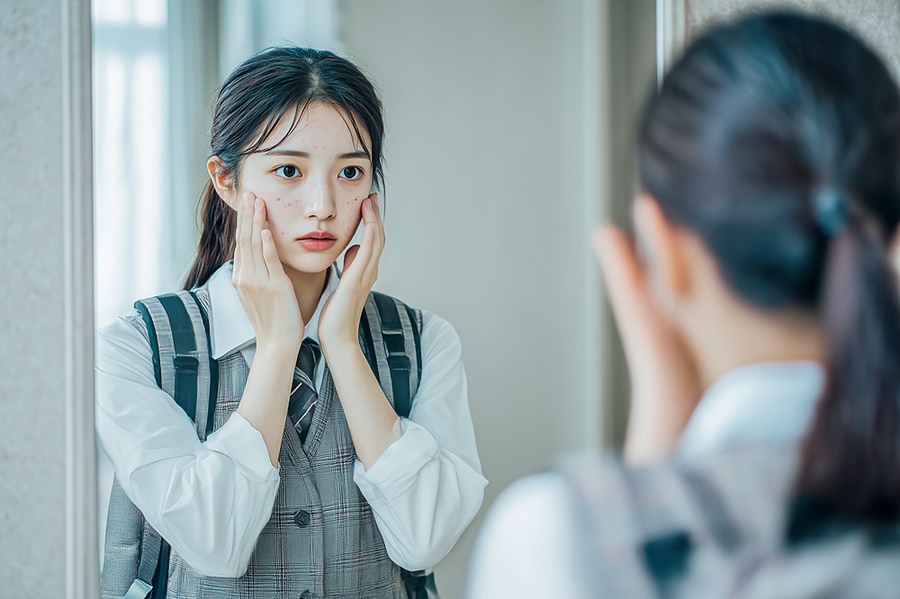 여드름 패인흉터 레이저 피부 고민의 실질적인 접근 관련 이미지 3