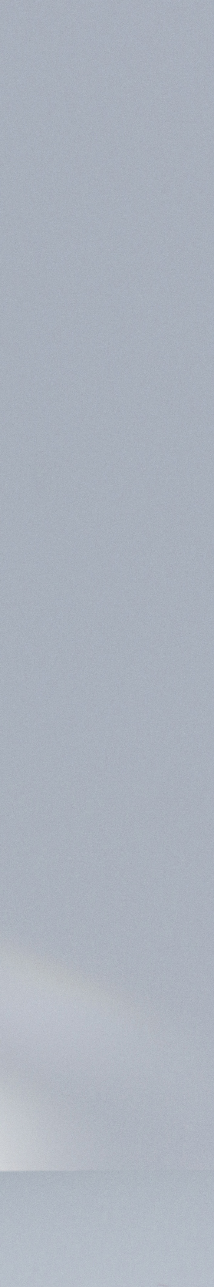 강남 온다리프팅 잘하는곳 어떻게 찾아야 할까 관련 이미지 31