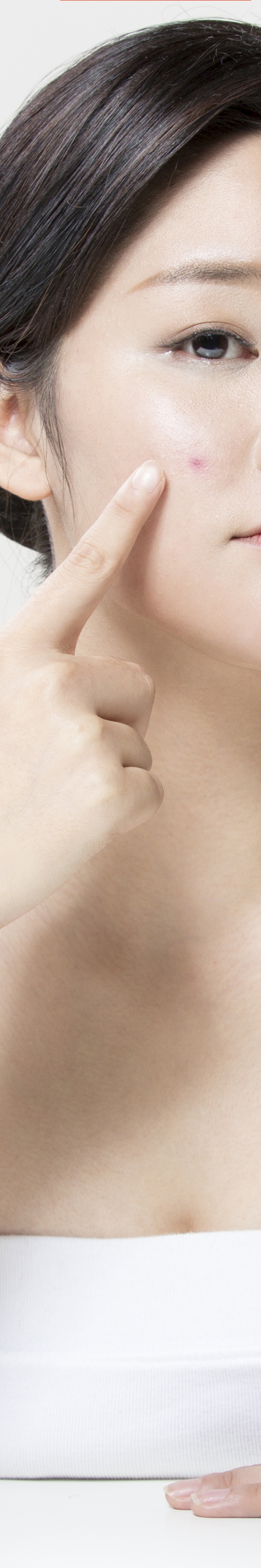 서초동여드름흉터 아프지 않게 관리하고자 관련 이미지 17