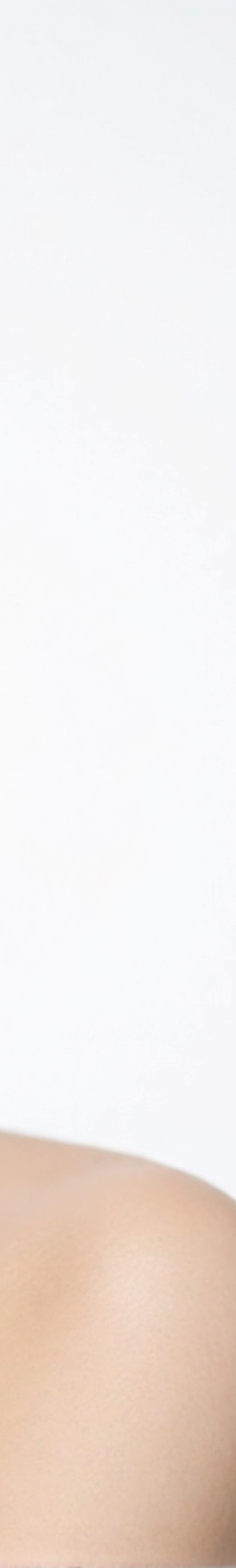 써마지 리프팅 처음 관리부터 중요하기 때문에 관련 이미지 22