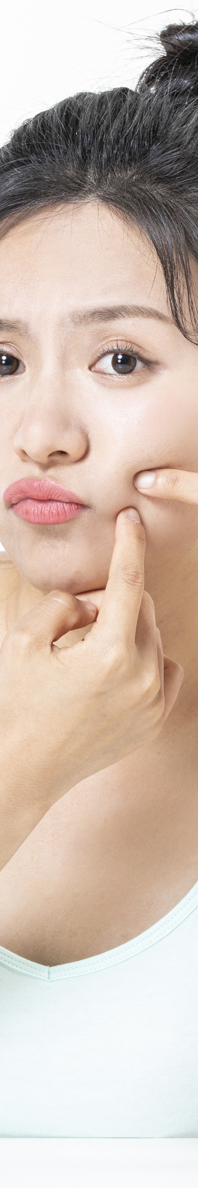 한관종 비립종 차이 어떻게 구분할 수 있을까 관련 이미지 30