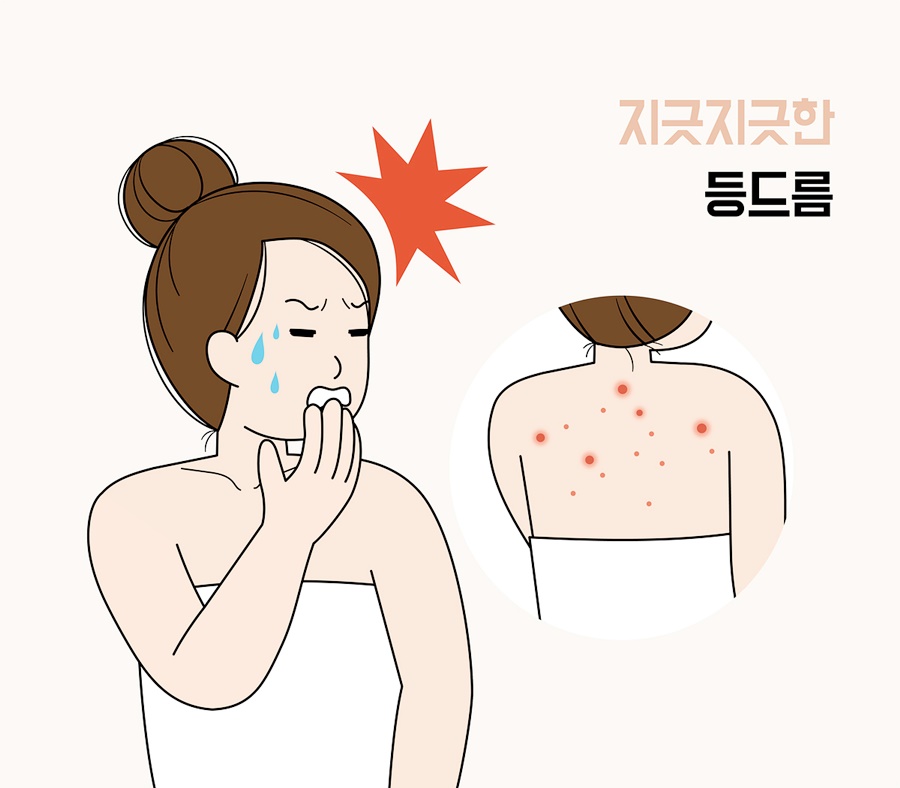 강남 등드름 알라딘 필링 받아야하는 이유 관련 이미지 3