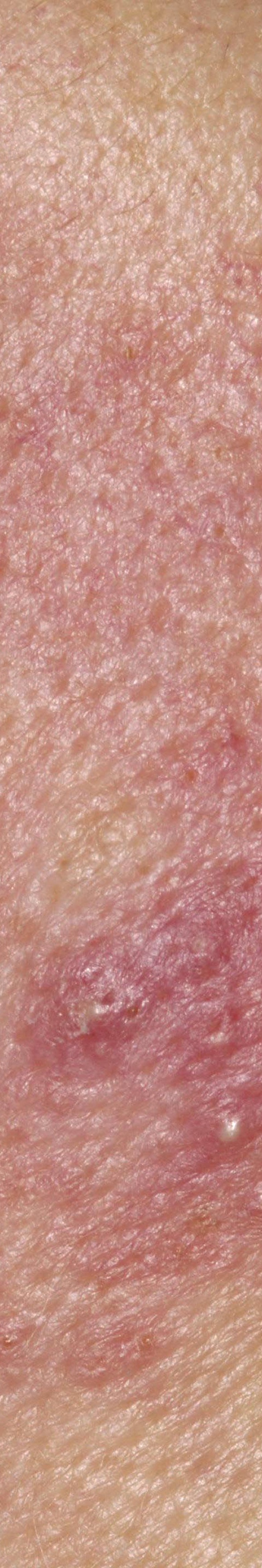 서초안면홍조 어떤 것부터 확인해야 할까 관련 이미지 18