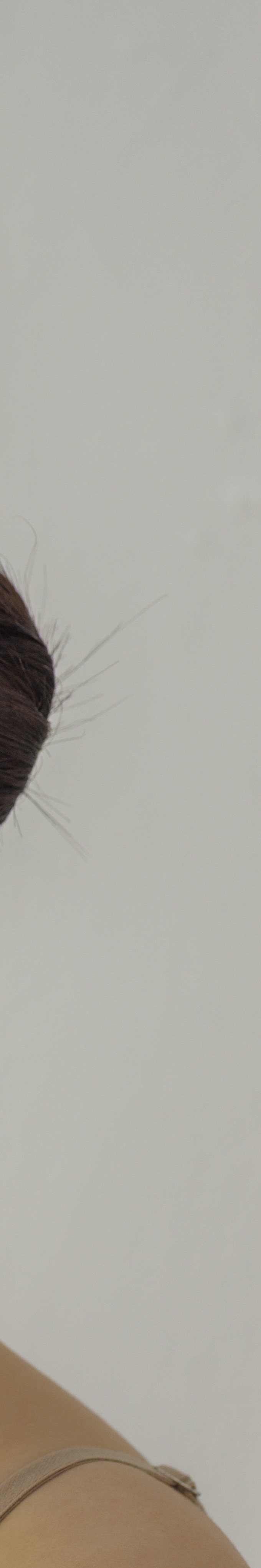 서초구 피부과 추천 여드름자국 때문에 고민된다면 관련 이미지 30