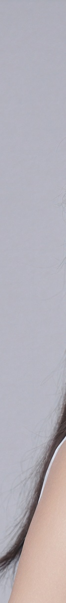 강남여드름흉터치료 확실하게 알고 있어야 관련 이미지 17