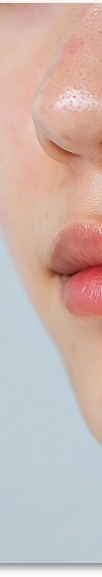 신논현역피부과 여드름 치료 흉터 관리를 위한 피부과전문의가 알려주는 방법 관련 이미지 25