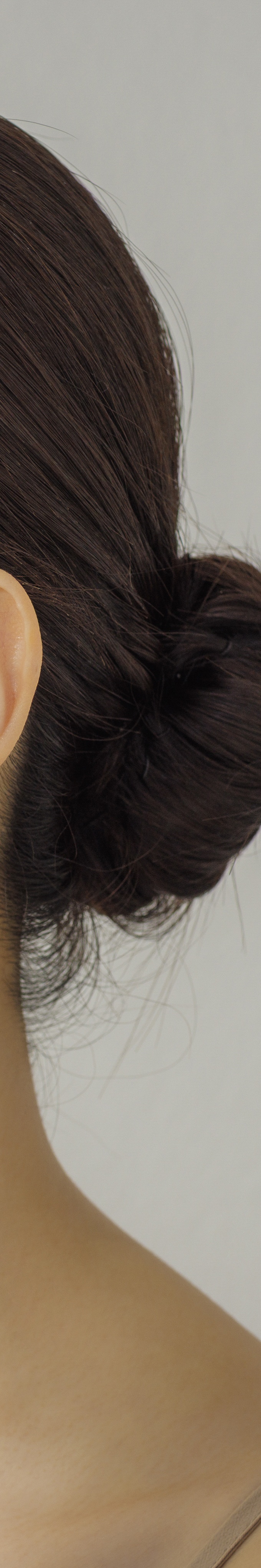 서초구 피부과 추천 여드름자국 때문에 고민된다면 관련 이미지 29