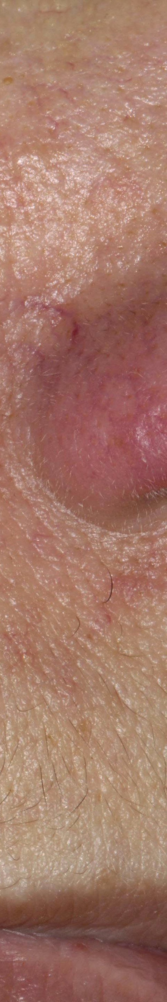 서초안면홍조 어떤 것부터 확인해야 할까 관련 이미지 22