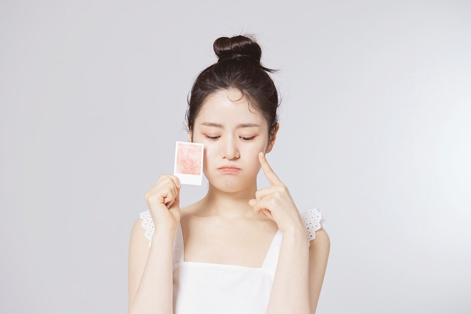 신논현역 여드름치료 흉터 종류에 따라 다른 방법 관련 이미지 7