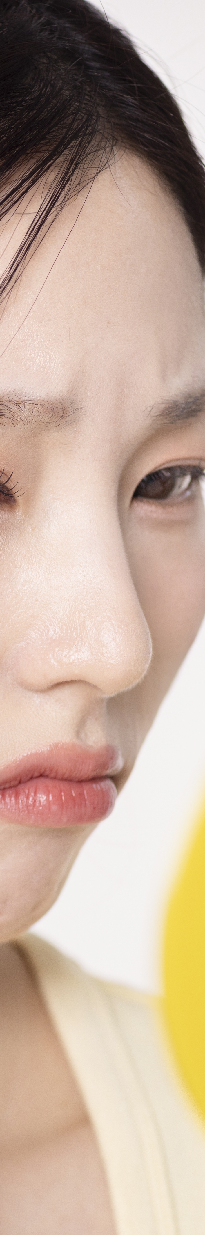 강남여드름흉터 치료 정확한 진단부터 시작해야 관련 이미지 19