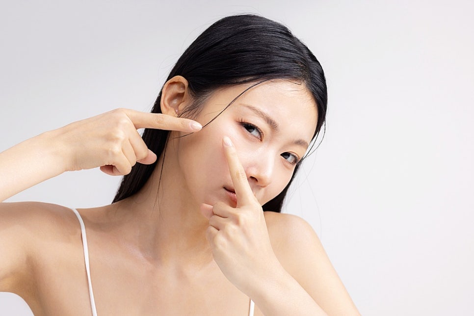 정자역 피부과 여드름 짜서 없앤다는 생각이 남기는 3가지 흔적 관련 이미지 10