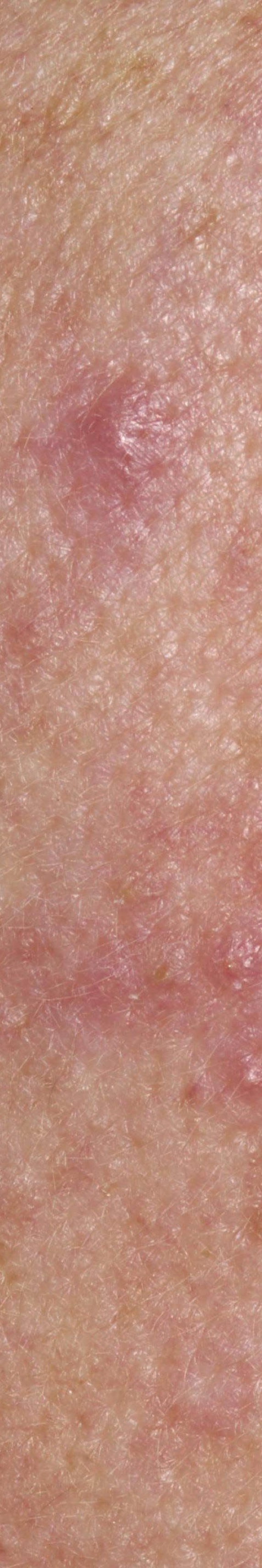 서초안면홍조 어떤 것부터 확인해야 할까 관련 이미지 16