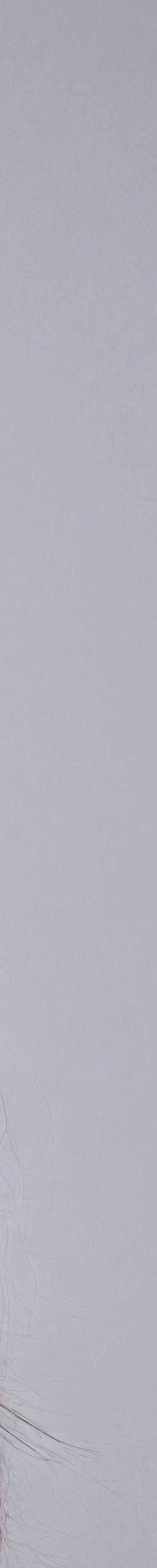역삼동써마지리프팅 어떤 분들에게 도움이 될까요 관련 이미지 22