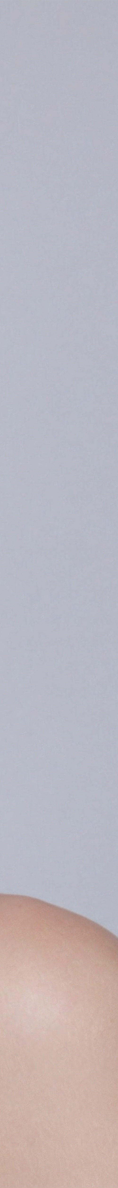 강남리프팅잘하는곳 유지기간이 중요하신 분들께 관련 이미지 32