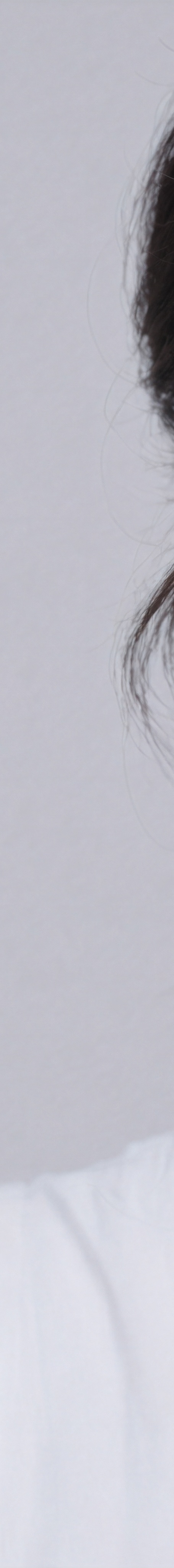 서초구 리프팅 어떤 부분을 체크할까 관련 이미지 15