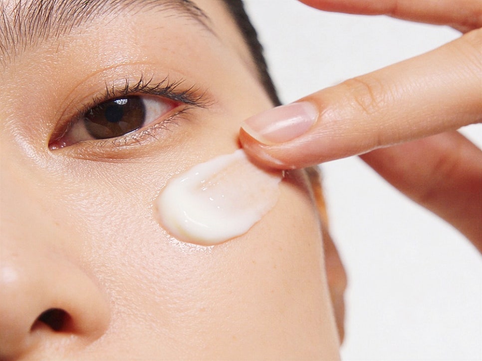 Three Differences You Miss When You Assume Facial Lentigines Are the Same as Moles image 5