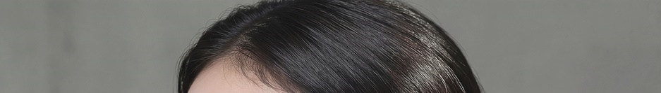 강남 쥬베룩 볼륨 효과 자연스러운 변화 관련 이미지 26