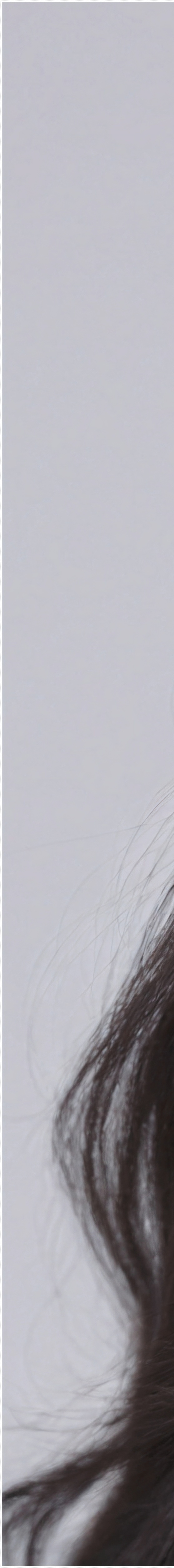 There Are Specific Criteria for Personally Evaluating Where to Get Good Thermage in Gangnam image 25