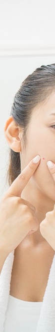 Treatment for Closed Comedones by a Dermatologist in Gangnam image 43