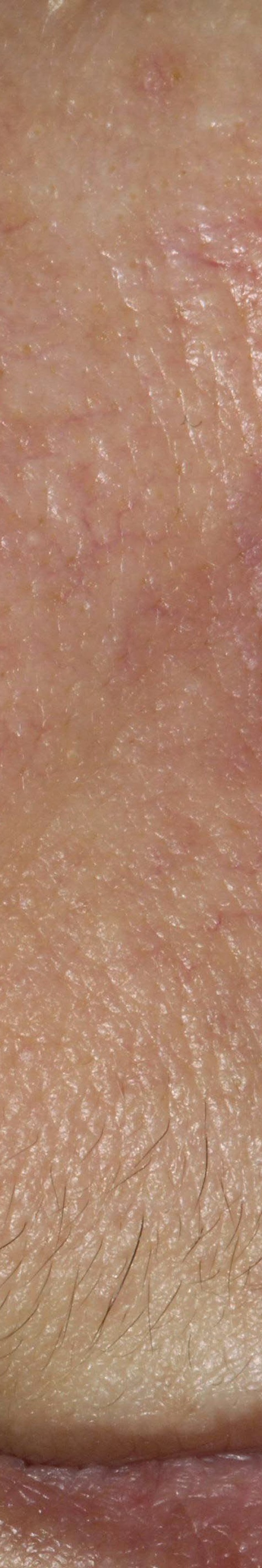 서초안면홍조 어떤 것부터 확인해야 할까 관련 이미지 21