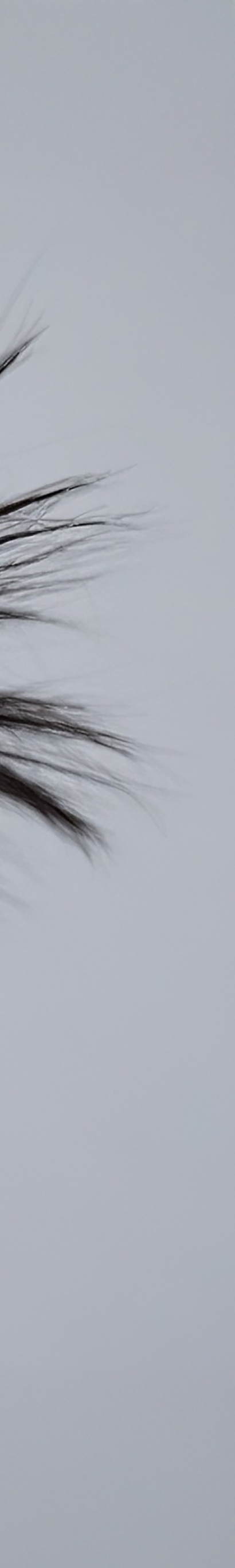 역삼동 써마지 자연스러운 탄력을 원한다면 관련 이미지 33