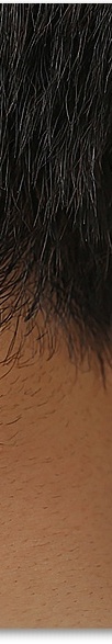 신논현역피부과 여드름 치료 흉터 관리를 위한 피부과전문의가 알려주는 방법 관련 이미지 40