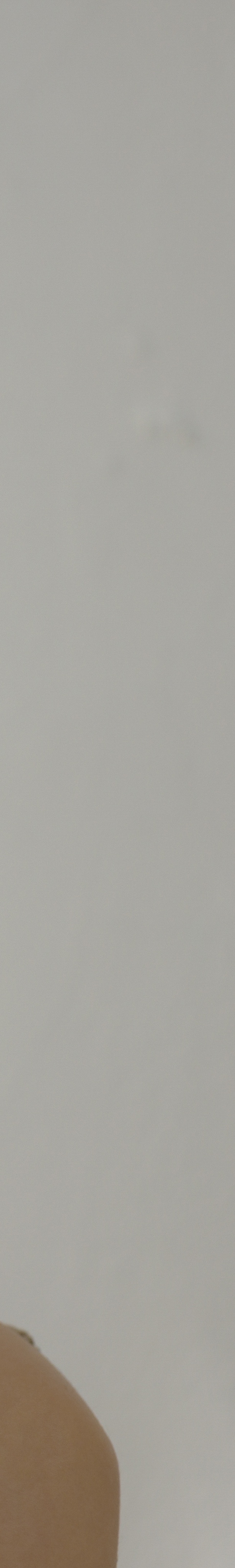 반포 써마지 주름과 탄력을 동시에 잡고 싶다면 관련 이미지 23