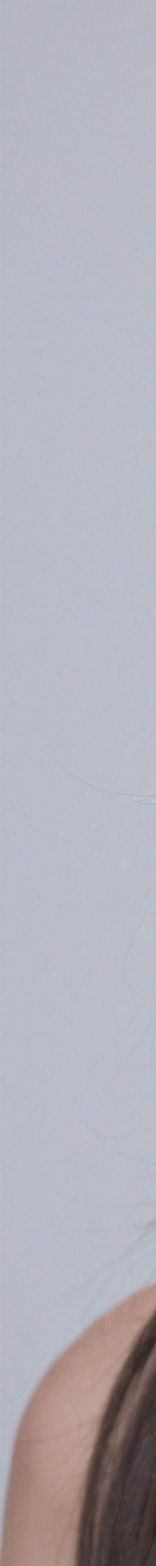 강남리프팅잘하는곳 유지기간이 중요하신 분들께 관련 이미지 24