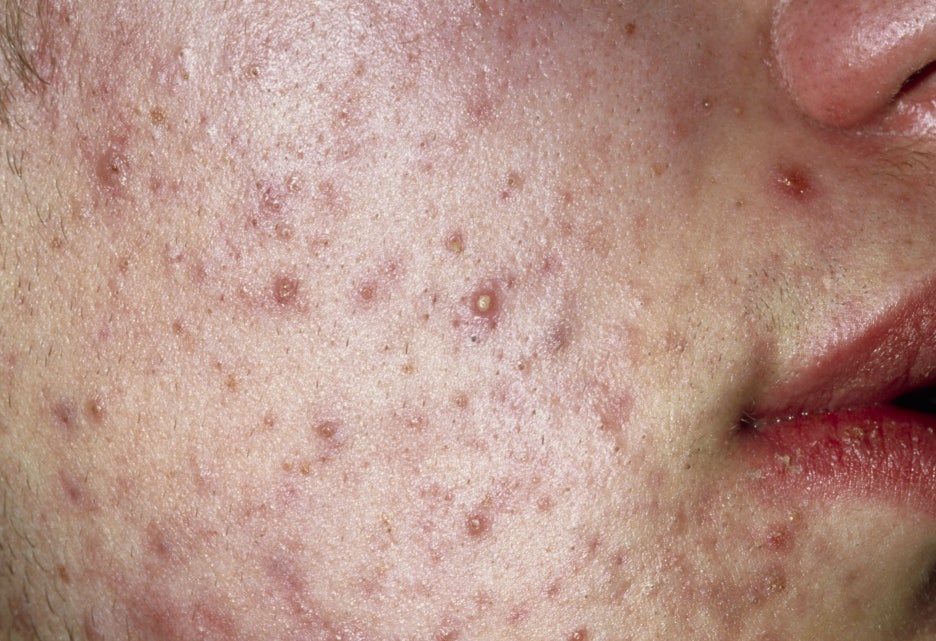 신논현역 피부과전문의 도대체 뭐가 다르길래 관련 이미지 3