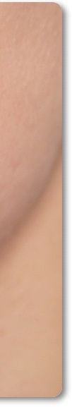신논현역피부과 여드름 치료 흉터 관리를 위한 피부과전문의가 알려주는 방법 관련 이미지 22
