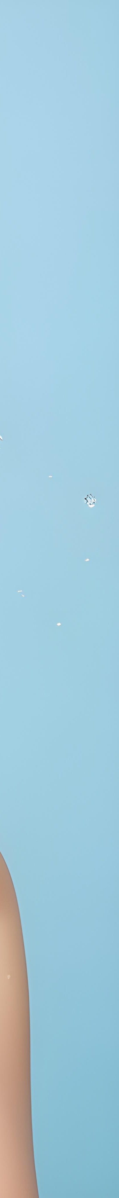 서초구 써마지 특징까지 정확히 알아야 관련 이미지 33