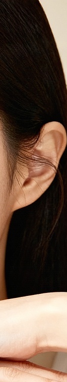 Treatment for Closed Comedones by a Dermatologist in Gangnam image 34