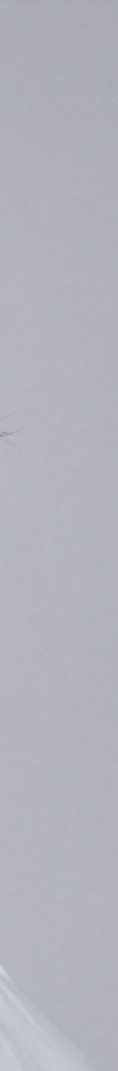 강남여드름흉터치료 확실하게 알고 있어야 관련 이미지 23