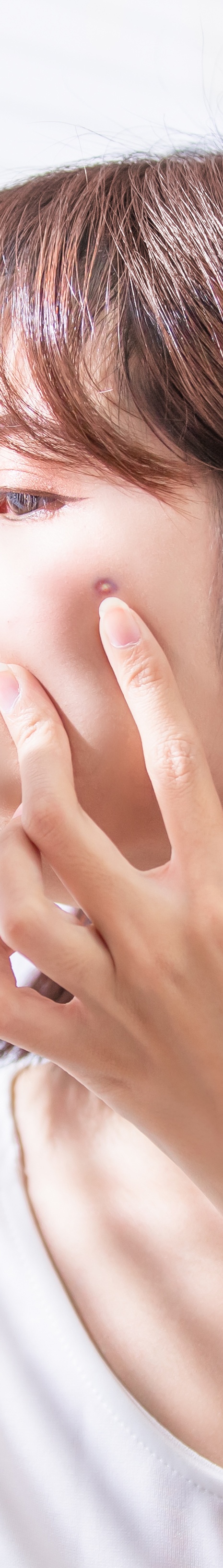 서초동여드름치료 뭐가 제일 중요할까 관련 이미지 18