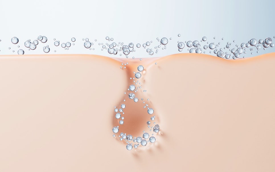 신논현역 여드름치료 흉터 종류에 따라 다른 방법 관련 이미지 5