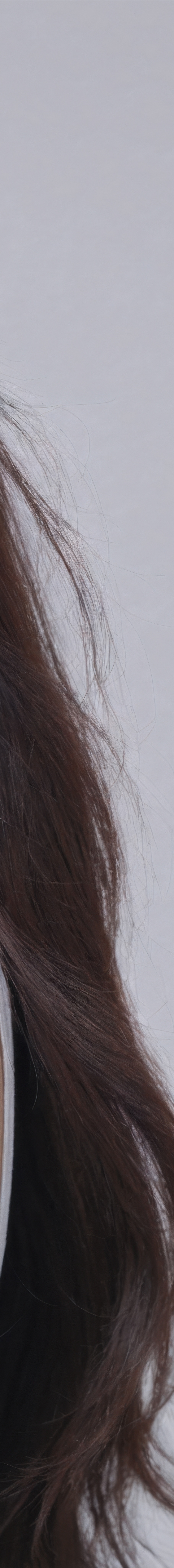 강남역여드름압출 아트레이저로 가능하기에 관련 이미지 30