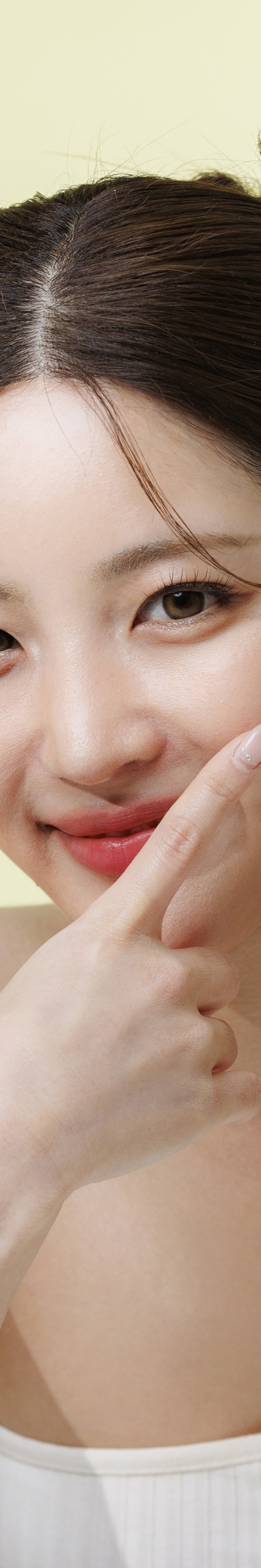 한관종 비립종 차이 어떻게 구분할 수 있을까 관련 이미지 20