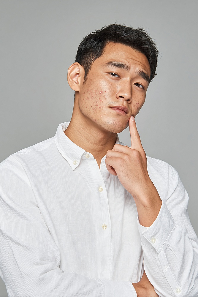 화농성 여드름 치료 집에서 짜면 안 되는 이유 관련 이미지 9