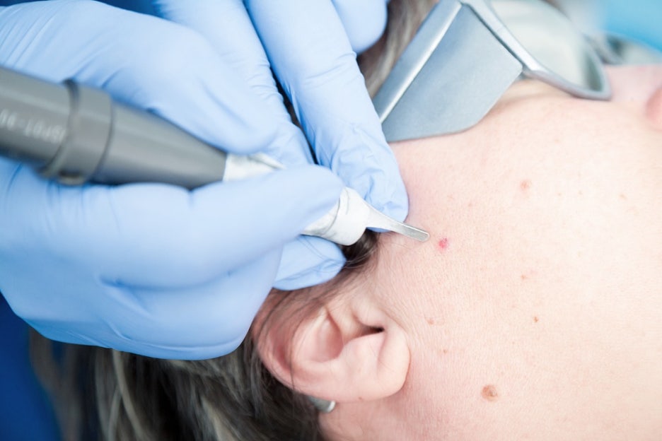 강남한관종제거 피부과 치료 관련 이미지 6